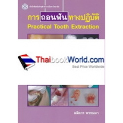 การถอนฟันทางปฏิบัติ : Practical Tooth Extraction